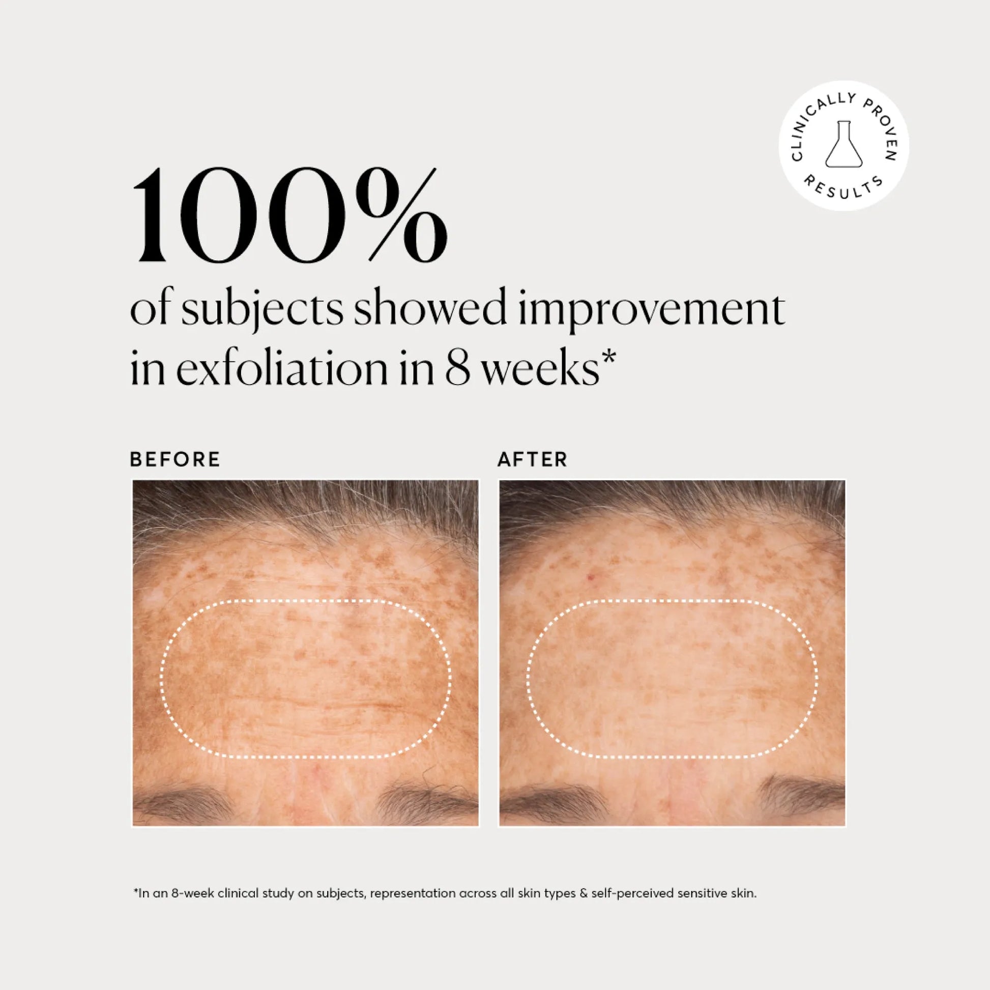 bha-liquid-exfoliant-2-m9 NATR-10027-Alt-Images-BHA-Liquid-Exfoliant-2_-03.webp
