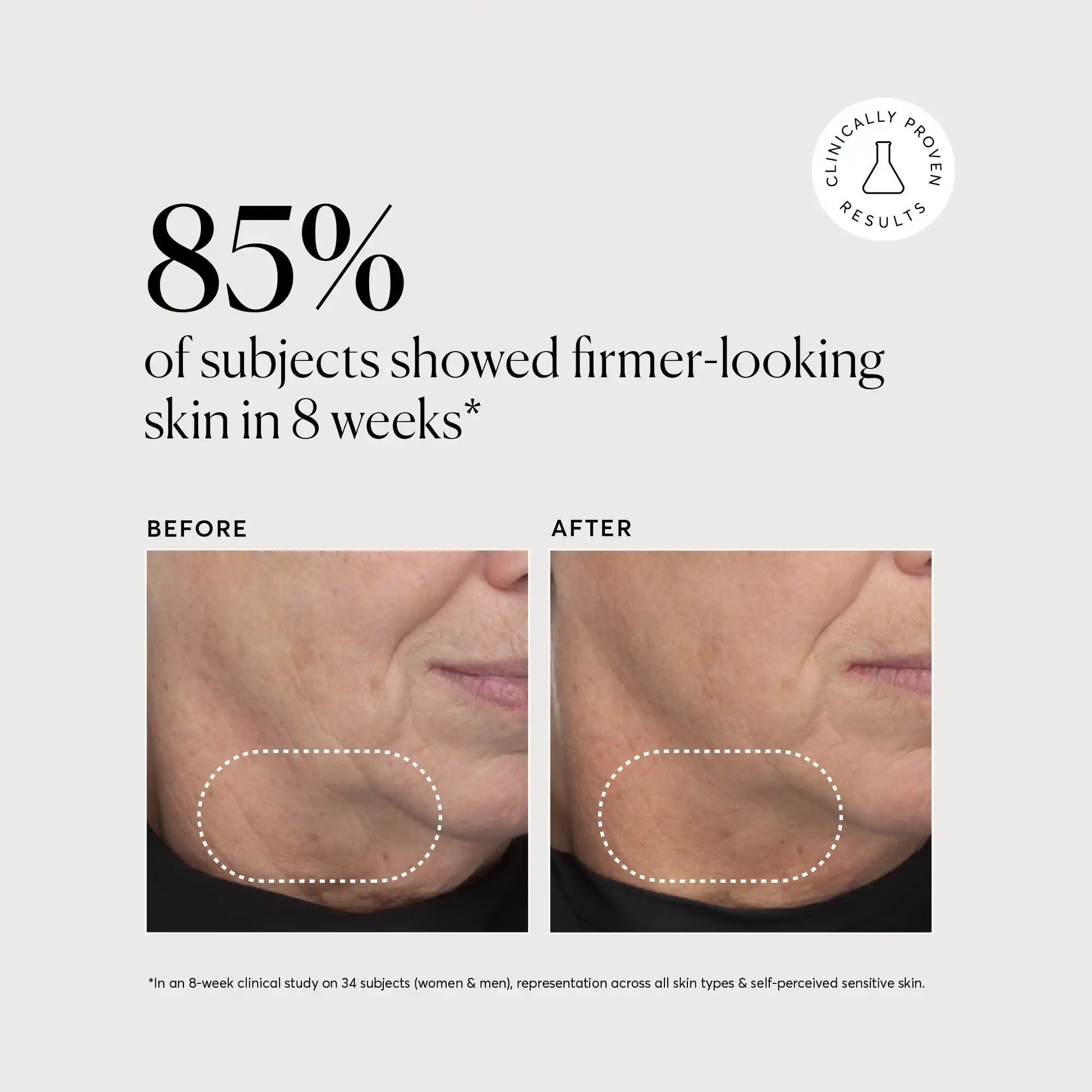 retinol-complex-serum-t8 NATR-10034-Alt-Images-Retinol-Complex-Serum-04.webp